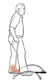 Vista lateral de un hombre con un bastón. Las flechas muestran dónde debería poner el pie lesionado y el bastón para sobrepasar su otro pie.