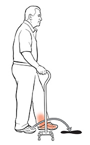 Vista lateral de un hombre con un bastón de cuatro patas. La flecha muestra dónde debería poner el otro pie.