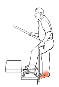 Vista lateral de un hombre con un bastón en las escaleras. Las flechas muestran dónde debería poner su bastón y el pie lesionado para subir las escaleras.