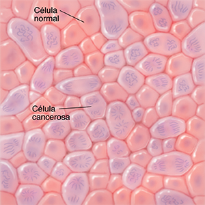 Vista microscópica de las células normales y las células cancerosas.