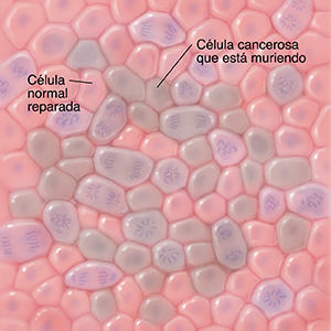 Vista microscópica de las células normales, las células reparadas y las células cancerosas que están muriendo.