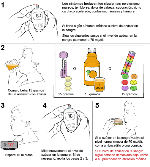 5 pasos para tratar el nivel bajo de azúcar en la sangre (hipoglucemia).