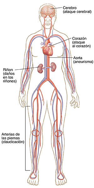 Vista frontal de un cuerpo que muestra el sistema circulatorio, el corazón, el cerebro y los riñones.
