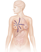 Contorno de una mujer, desde la cabeza hasta la parte media del muslo. Se ven flechas que muestran que el cáncer de mama se ha propagado a varios órganos.