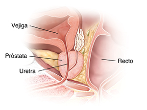 Corte transversal de una glándula prostática.