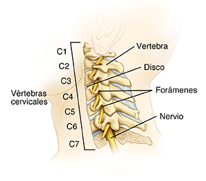 Vista lateral de la columna cervical con un corte transversal de la vértebra inferior para mostrar la médula espinal.