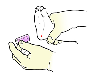 Primer plano de manos con guantes retirando la lanceta del talón de un bebé después de la punción en el talón.