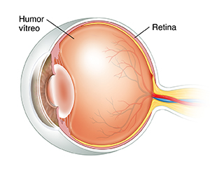 Corte transversal de tres cuartos de un ojo donde se observa el humor vítreo.