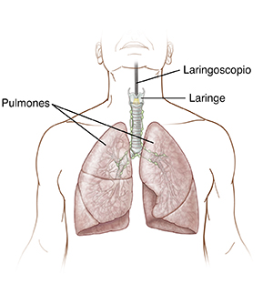 Vista frontal del torso de un hombre en el que se ve un endoscopio colocado en la garganta a la altura de la laringe.