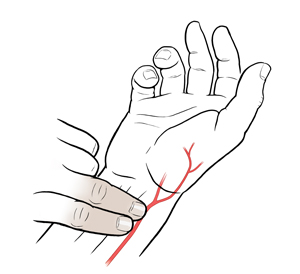 Mano con la palma hacia arriba donde se observa la ubicación de la arteria radial. Dos dedos de la mano contraria tomando el pulso radial.